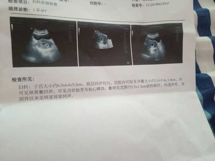 北京38岁供精供卵，北京供卵试管中心、北京供供卵试管、北京腹腹机构