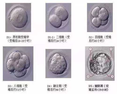 阳江捐卵：多囊卵巢到底多可怕 仅仅是影响怀孕