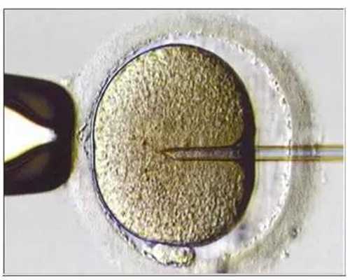 大同捐卵_什么是卵巢囊肿什么是卵泡？
