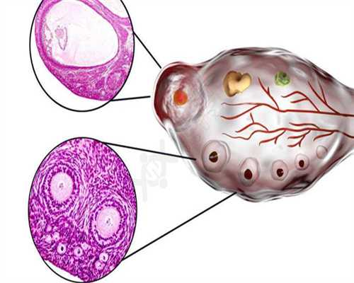 西北捐卵库,什么是免疫性不孕：卵子和精子互相排斥？
