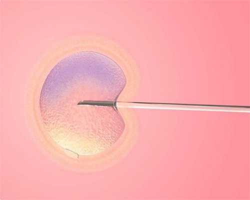 延边中国女生捐卵-多囊卵巢综合征的临床表现和治疗