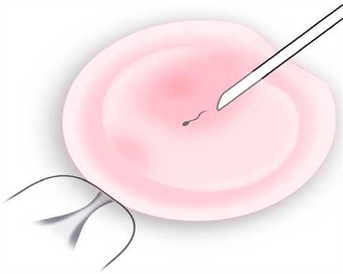 温岭中国捐卵价格_广州供卵试管第三代试管婴儿检查注意事项有哪些？