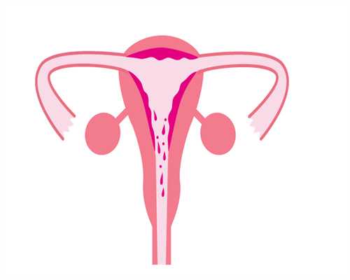 无锡捐卵的方式,泰国试管过程如何避免卵巢过度刺激综合征