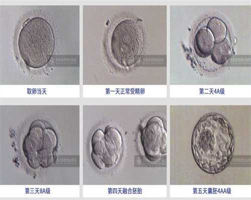 泰安正规买卵子多少钱一颗，输卵管积水赴广州供卵试管试管婴儿是否真的可行